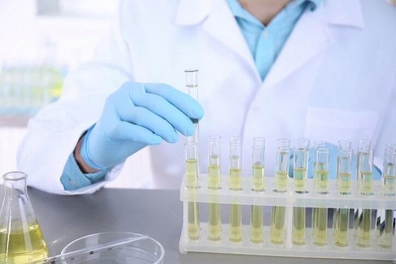 Xét nghiệm nước tiểu 24h