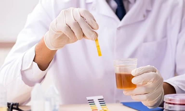 Hướng dẫn lấy nước tiểu giữa dòng