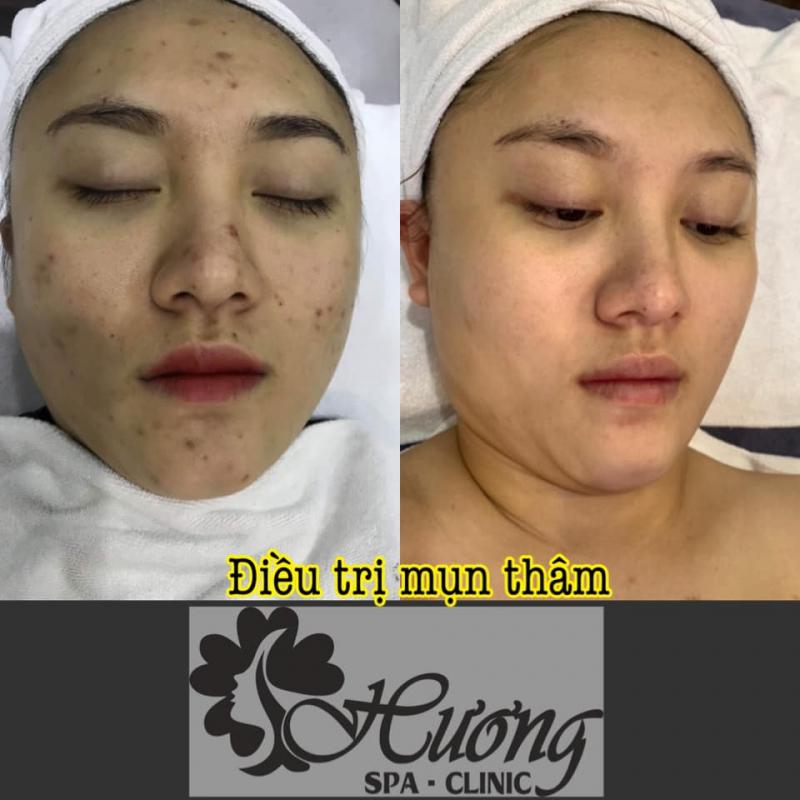 Hương Spa & Clinic