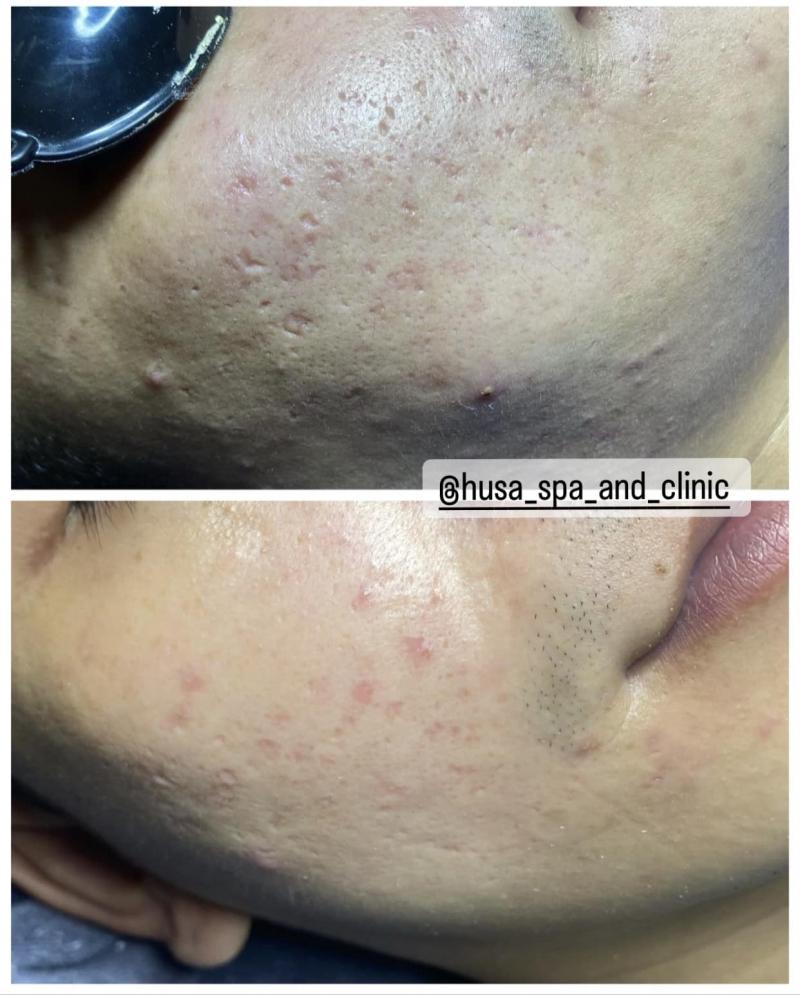 Husa Spa and Clinic
