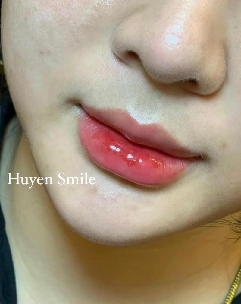 Huyền Smile Beauty