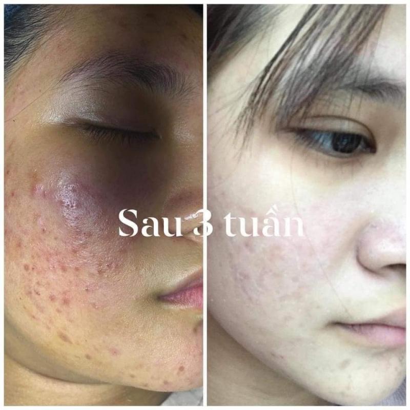 Jasmine Spa Quảng Ngãi