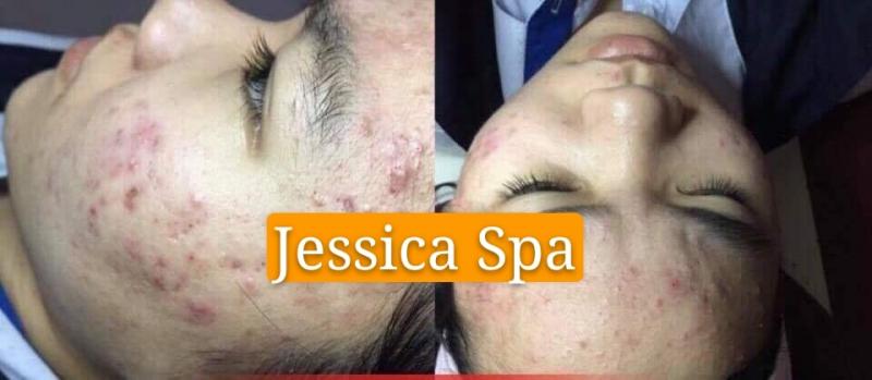 Jessica Spa Nha Trang