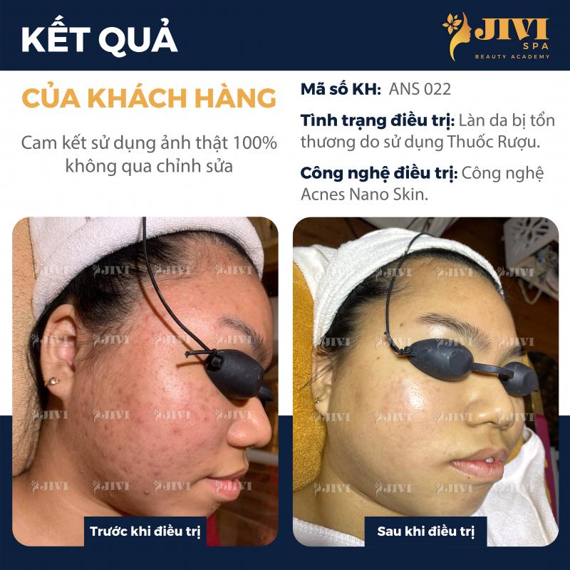JIVI SPA