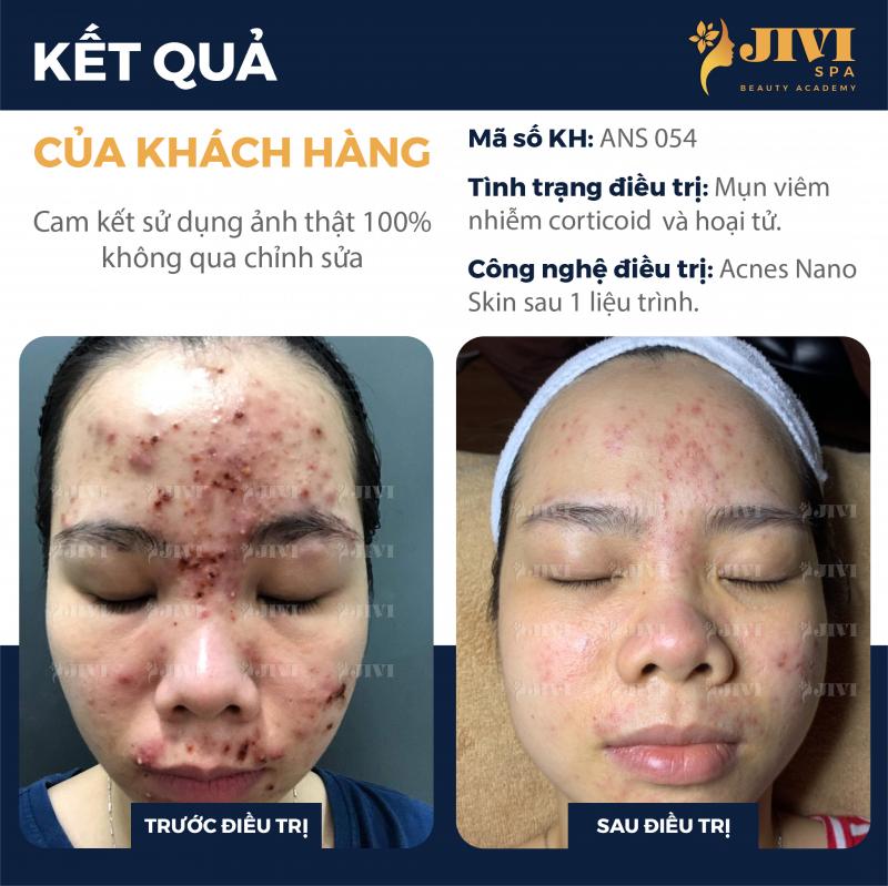 JIVI SPA