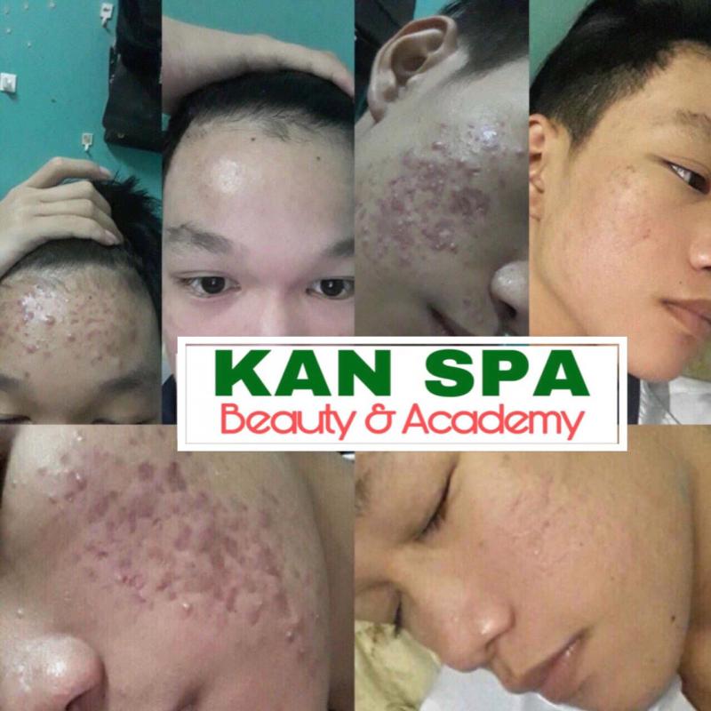 Kan Spa Beauty
