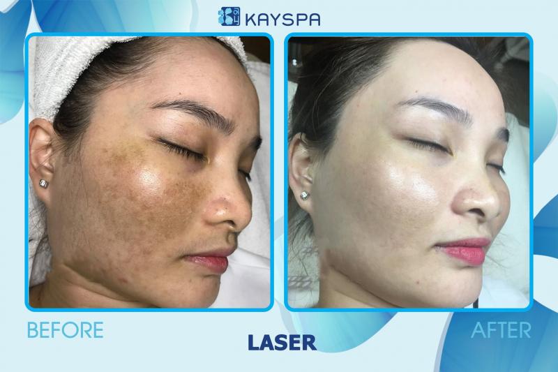 Kay Spa