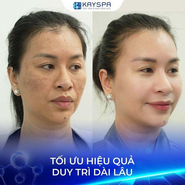 Kay Spa Bình Dương
