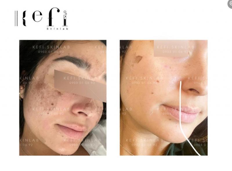 Kefi Skinlab