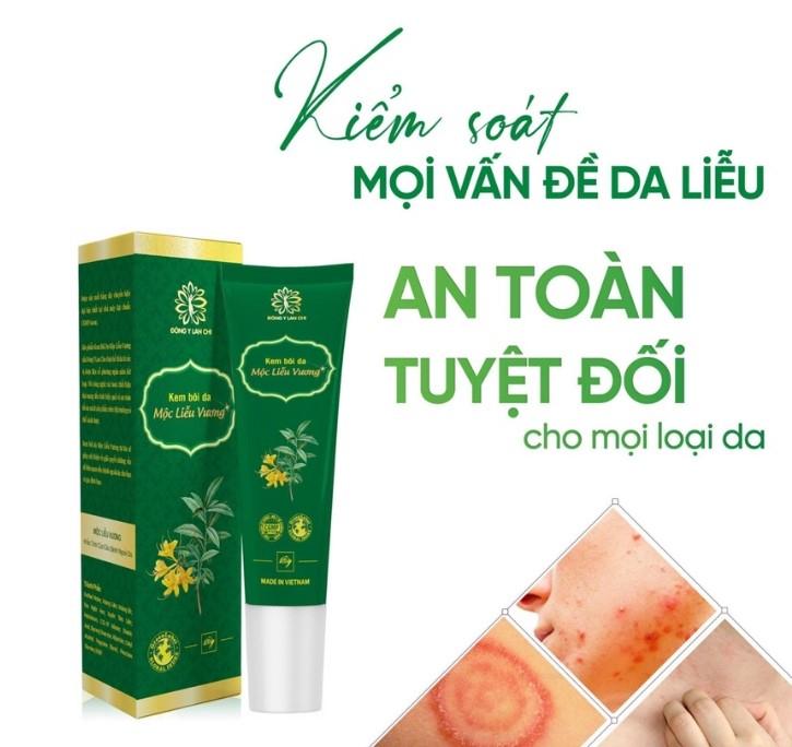 Kem bôi da dị ứng mẩn ngứa Mộc Liễu Vương