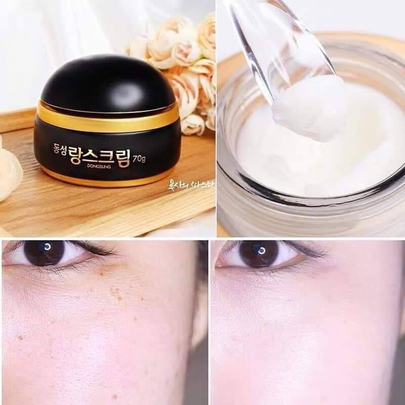 Kem dưỡng cao cấp mờ tàn nhang DongSung Rannce Cream