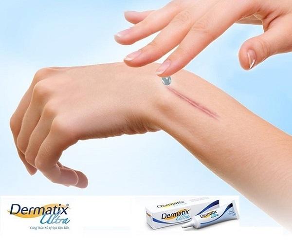 Kem trị sẹo Dermatix