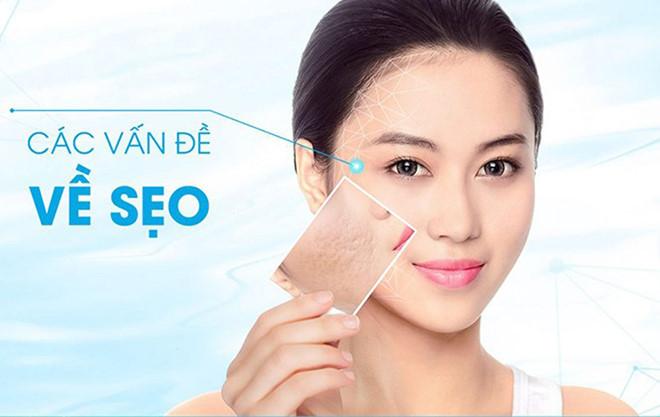 Kem trị sẹo Janssen commetic scar cream