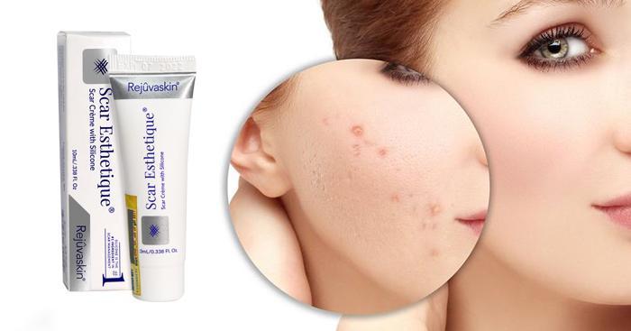 Kem trị sẹo Scar Esthetique