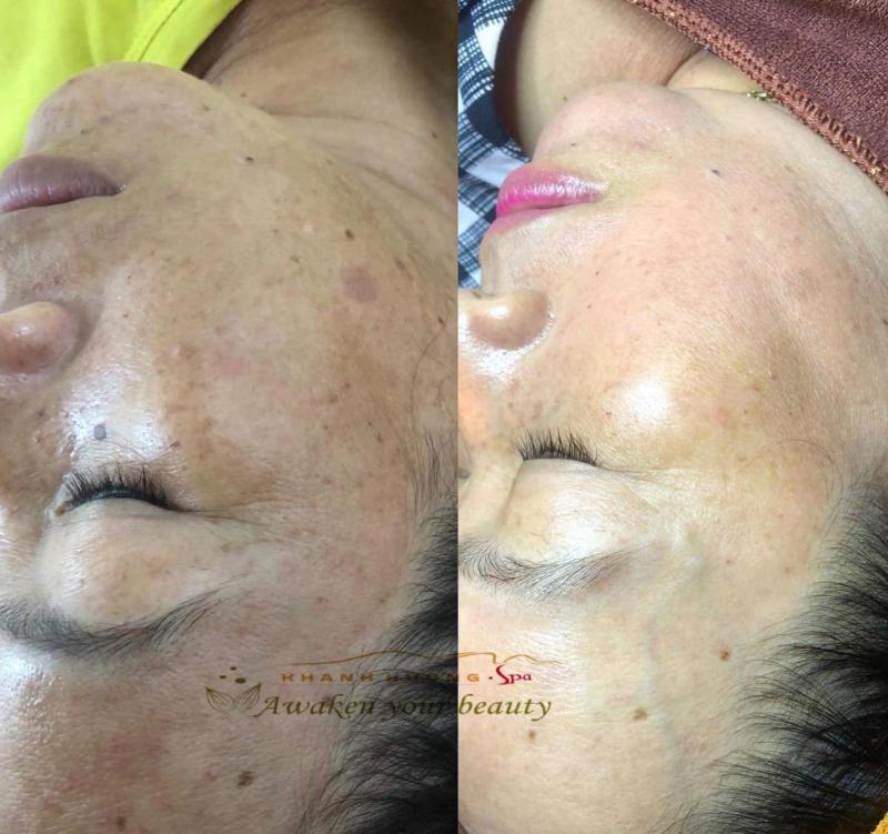 Khánh Hương Spa