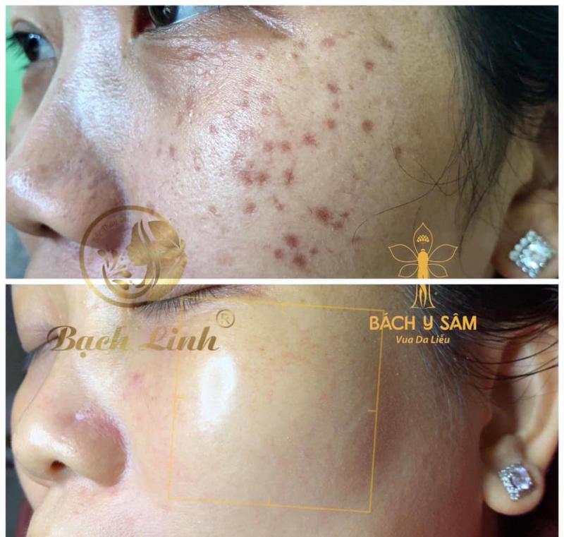 Khánh Vân Spa