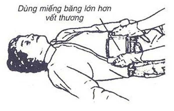Khi ruột bị lòi ra ngoài