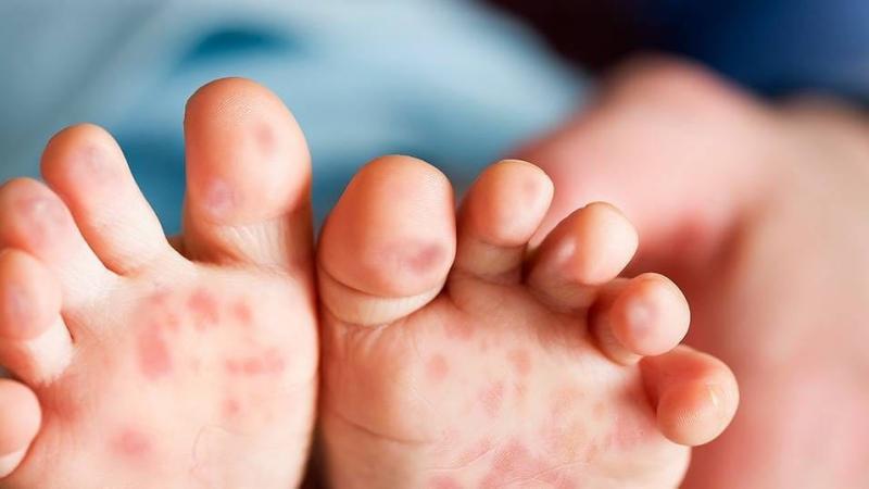 Đừng ngần ngại reo điện thoại và tìm sự giúp đỡ chuyên nghiệp khi bạn nhận thấy bất kỳ dấu hiệu nghi ngờ nào liên quan đến khó thở ở trẻ