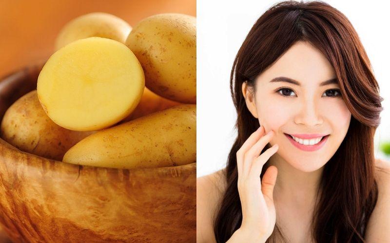 Trị thâm mụn với khoai tây