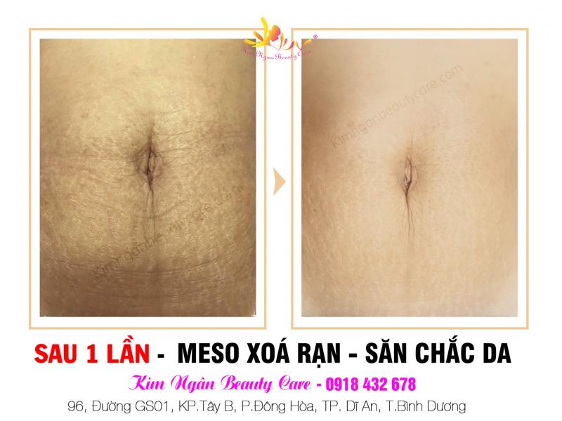 Kim Ngân Beauty Care