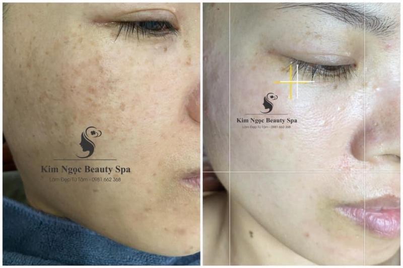 Kim Ngọc Beauty Spa
