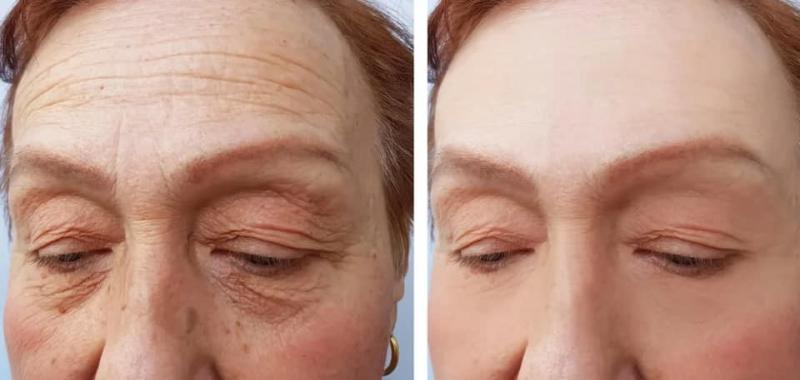 KiO Spa & Clinic