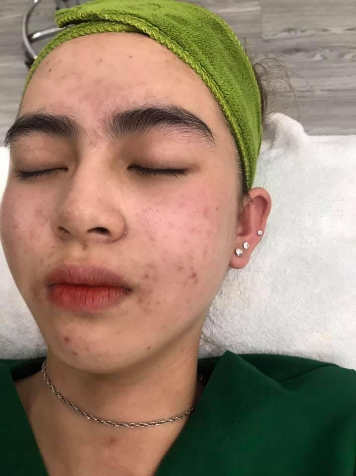 KiO Spa & Clinic Tam Kỳ