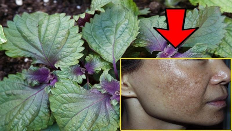 Lá tía tô tác dụng trị nám tuyệt vời