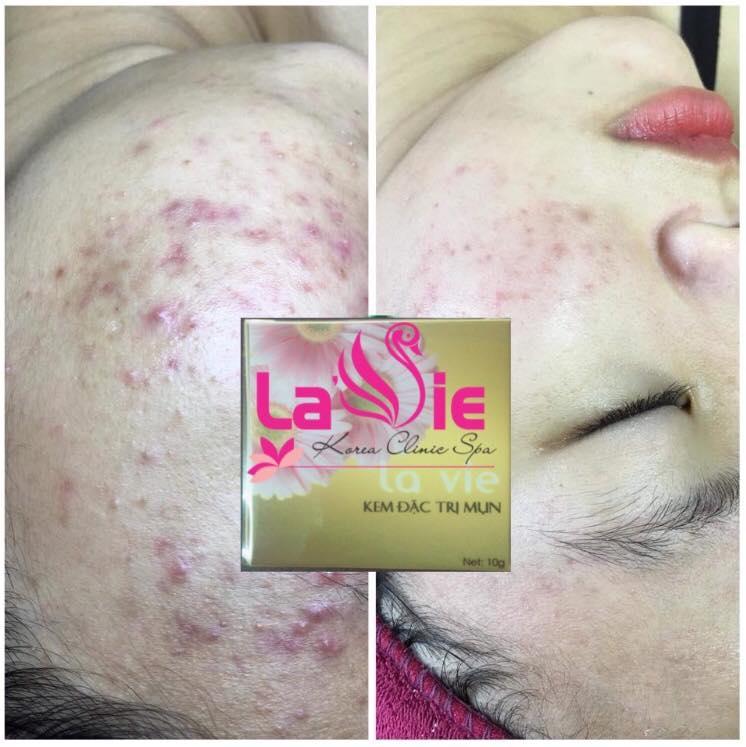 Lavie Spa