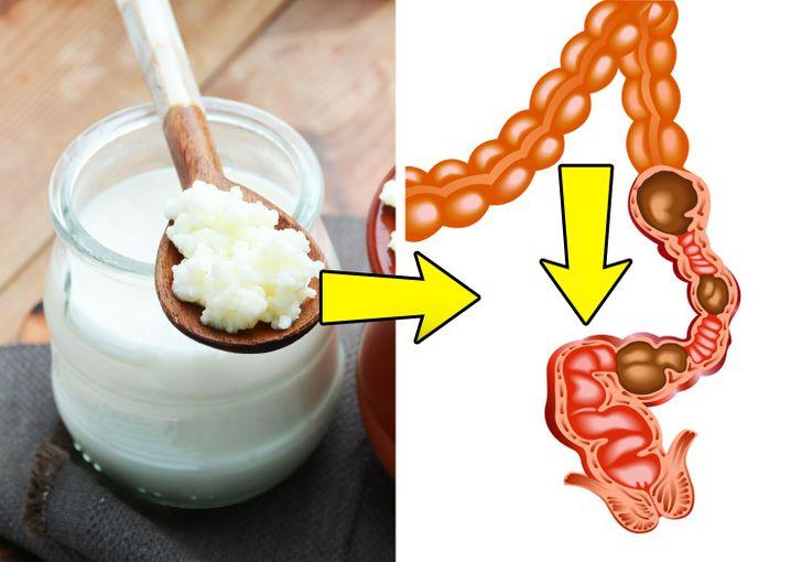 Làm men vi sinh hoặc thực phẩm chứa probiotic yêu thích của bạn