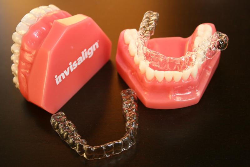 Làm thế nào Invisalign hoạt động để điều chỉnh vị trí của răng?