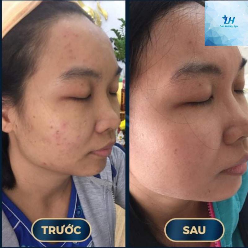 Lan Hương Home Spa Đồng Xoài