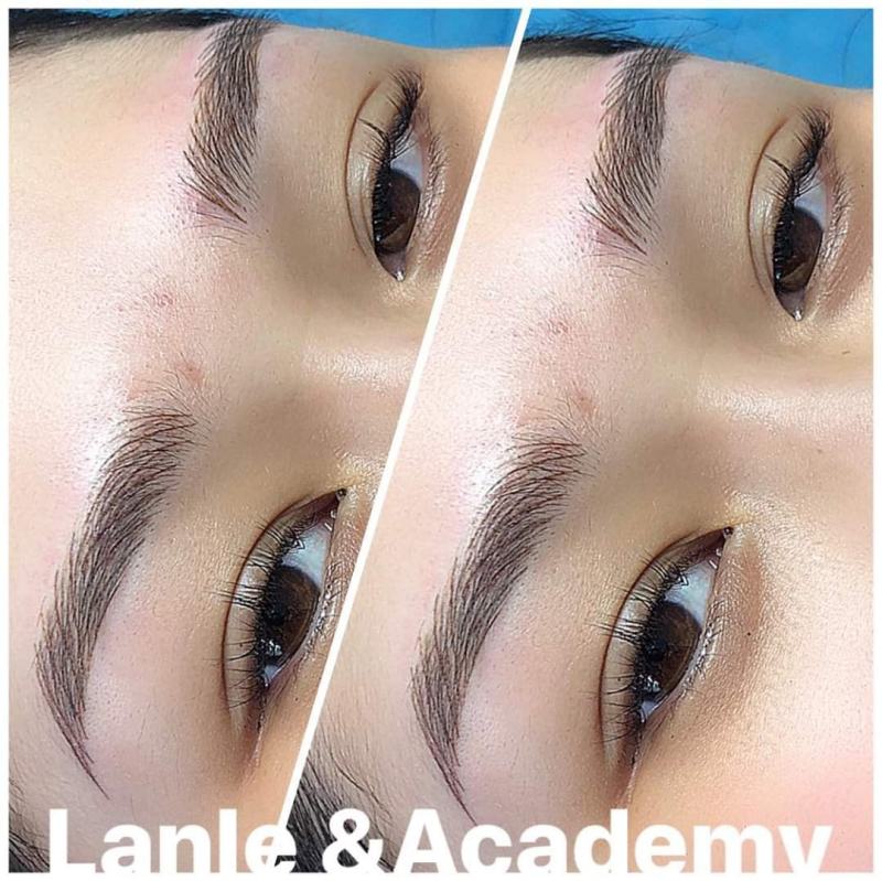Thẩm mỹ Ngọc Lan