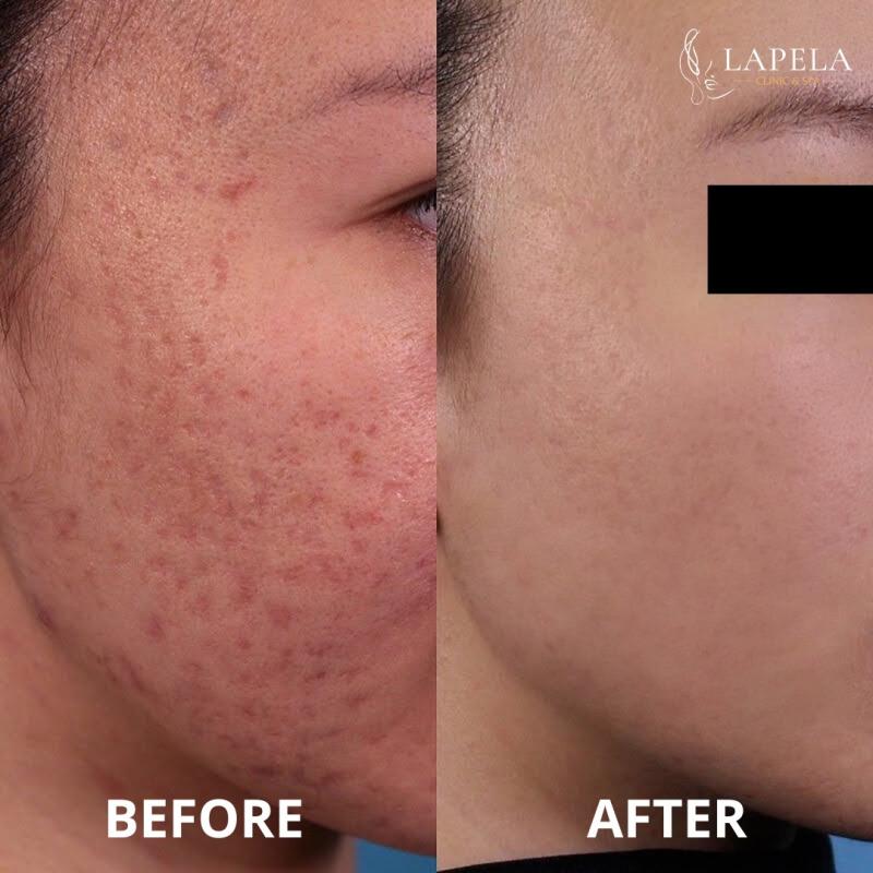 Lapela Clinic