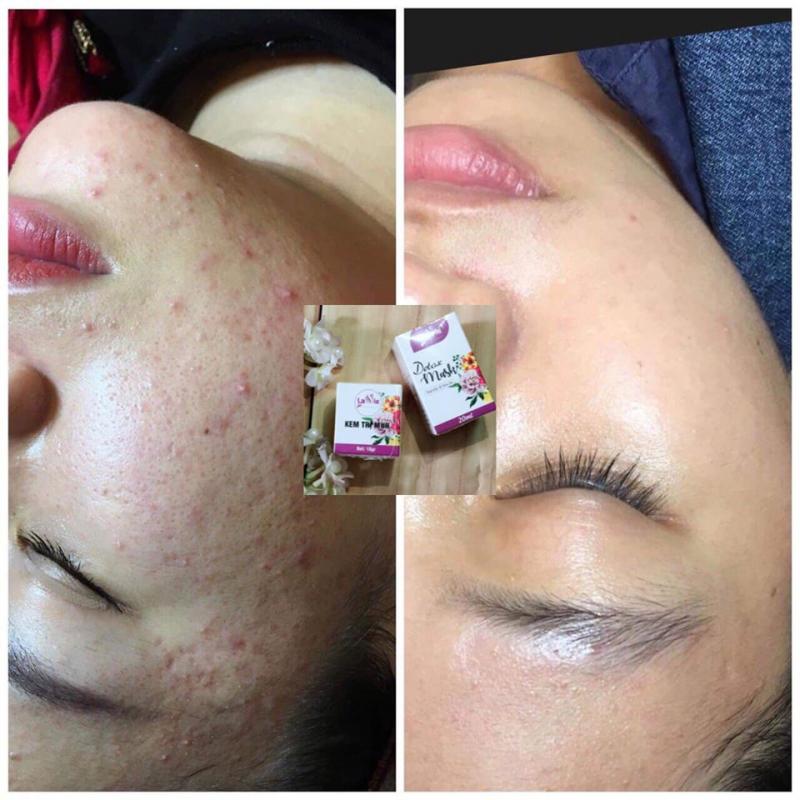 Lavie Spa