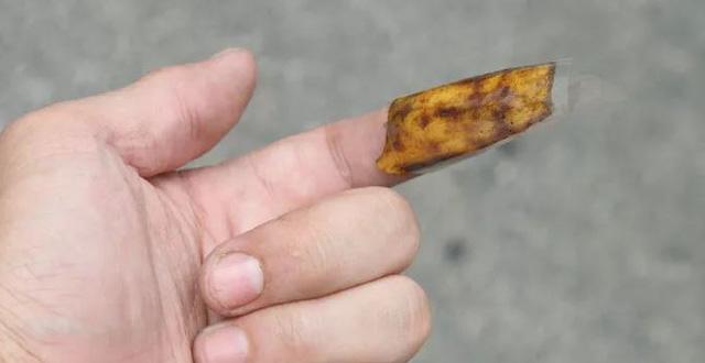Lấy dằm ra khỏi tay