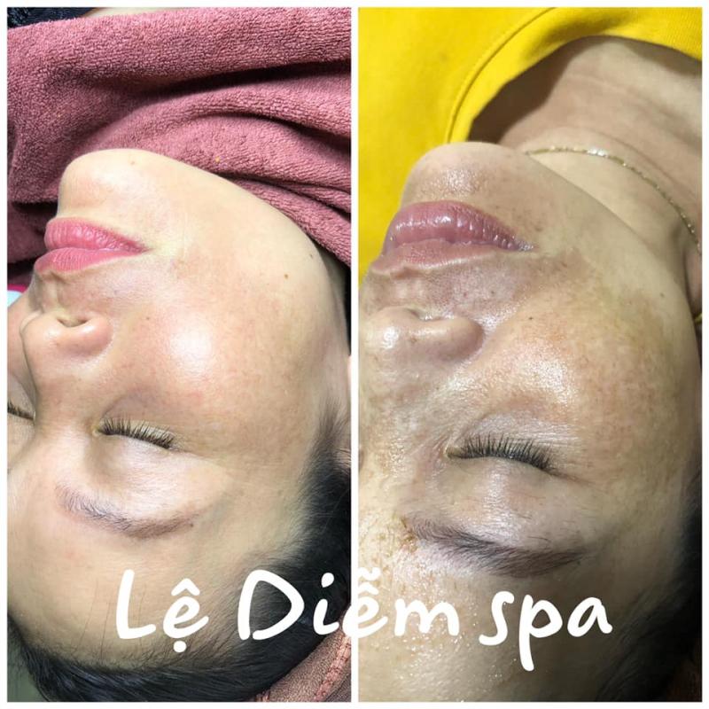 Lệ Diễm Spa