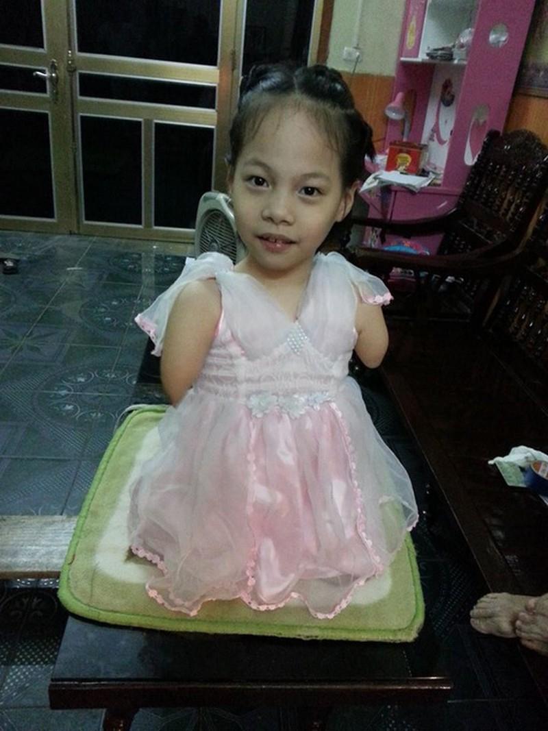 Linh Chi: “Nick Vujicic” Việt Nam