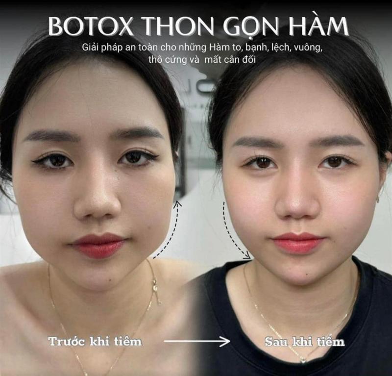 Linh Mi Xinh