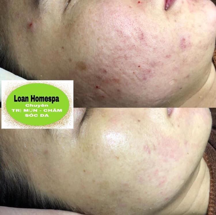 Loan Homespa