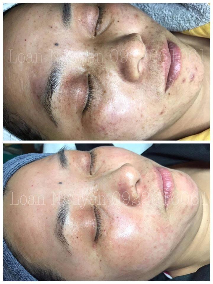 Loan Nguyen Skincare & Spa