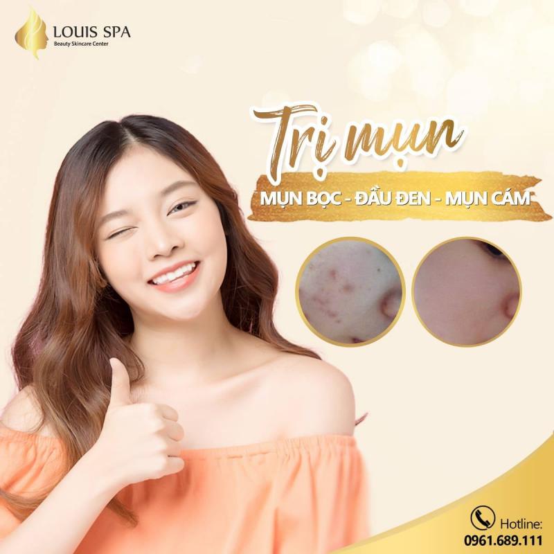 LOUIS SPA Đông Hà