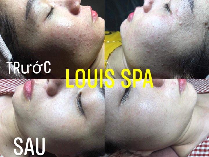 Louis Spa Quảng Ngãi
