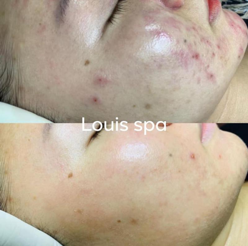 Louis Spa Quảng Ngãi