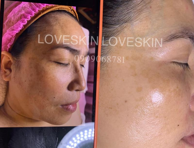 LoveSkin Spa