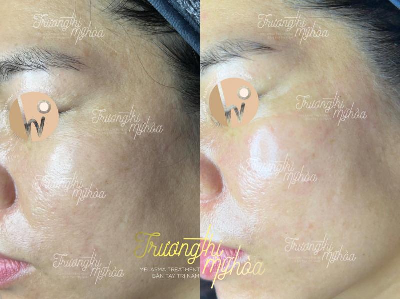 LoveSkin Spa