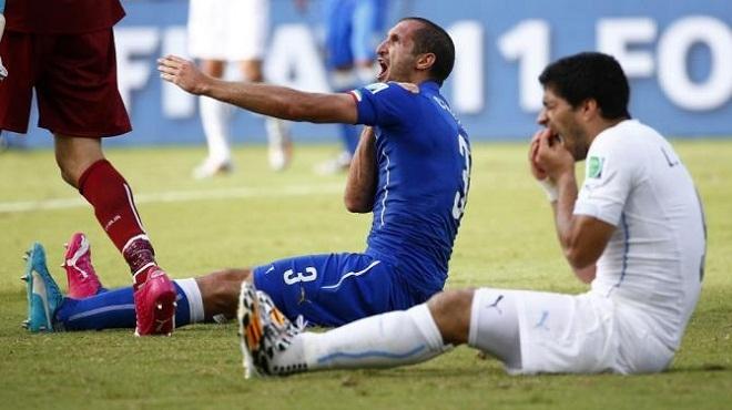 Hình ảnh sau khi Suarez cắn vào vai Chiellini tại vòng chung kết World cup 2014