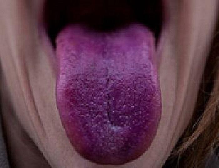 Đây là dấu hiệu chứng tỏ bạn đang có vấn đề về lưu thông máu