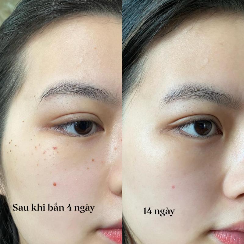 Luxury Spa Cẩm Phả