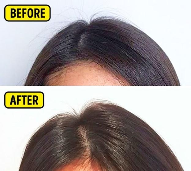 Mái tóc mỏng